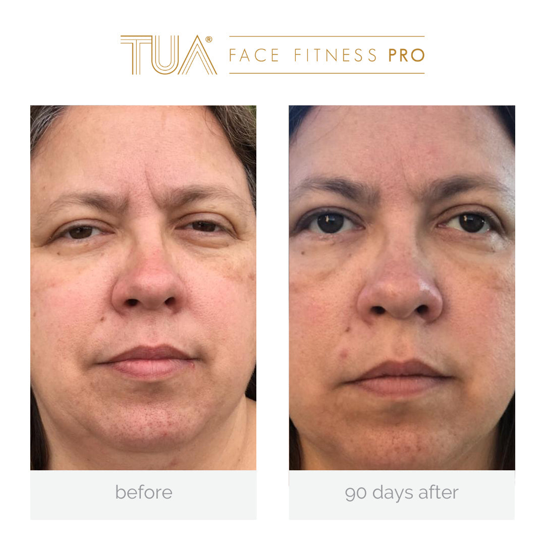 Showcasing of immediate result of using the best face toning device from TUA