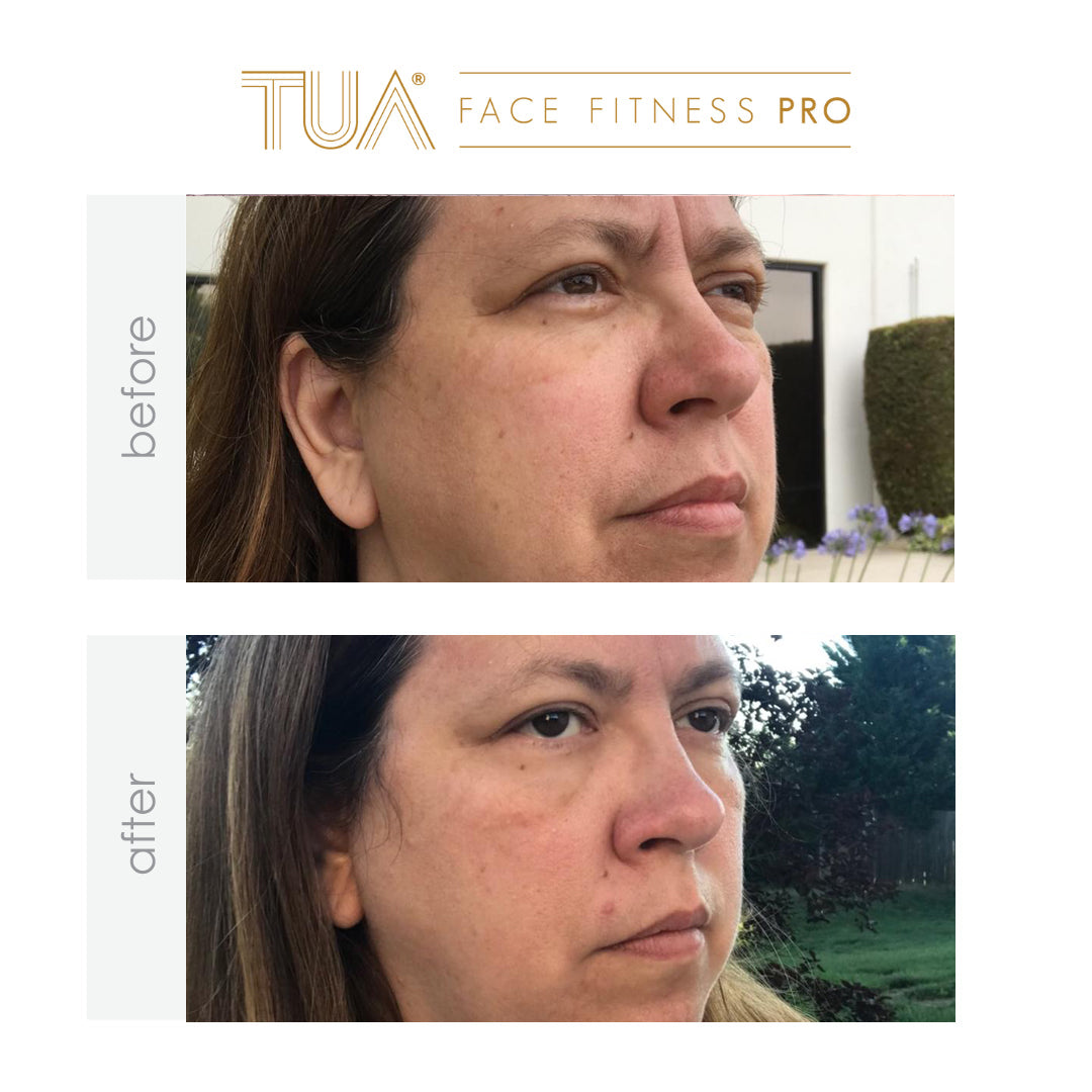 Showcasing of immediate result of using the best skincare device from TUA