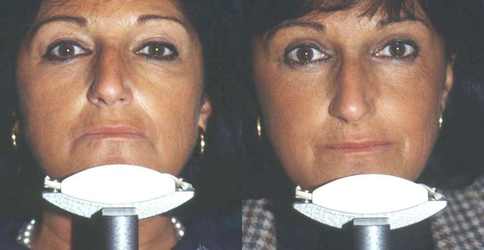 Close-up on skin-toning session with the best skincare device