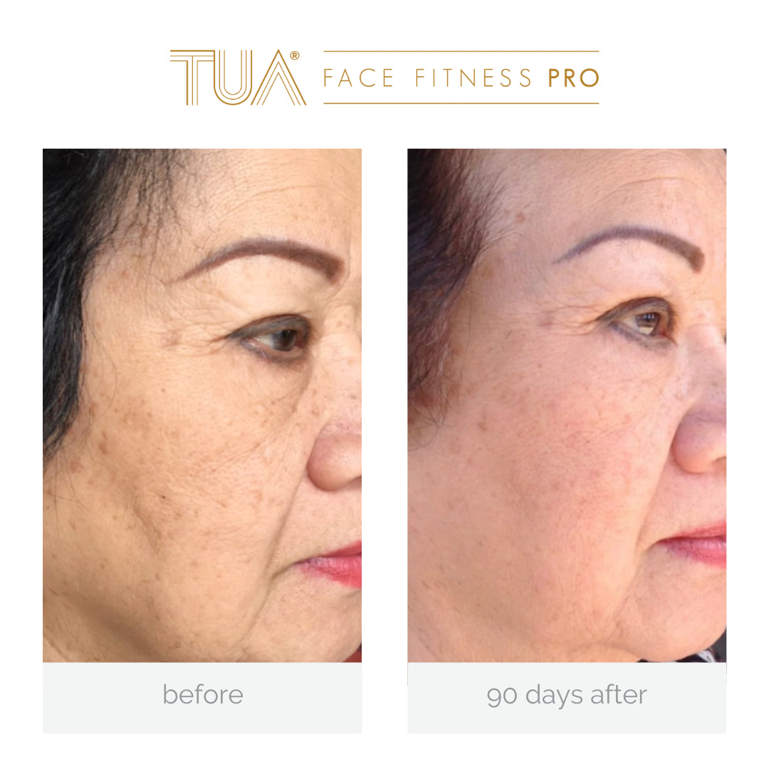 Showcasing of immediate result of using the best face toning device from TUA