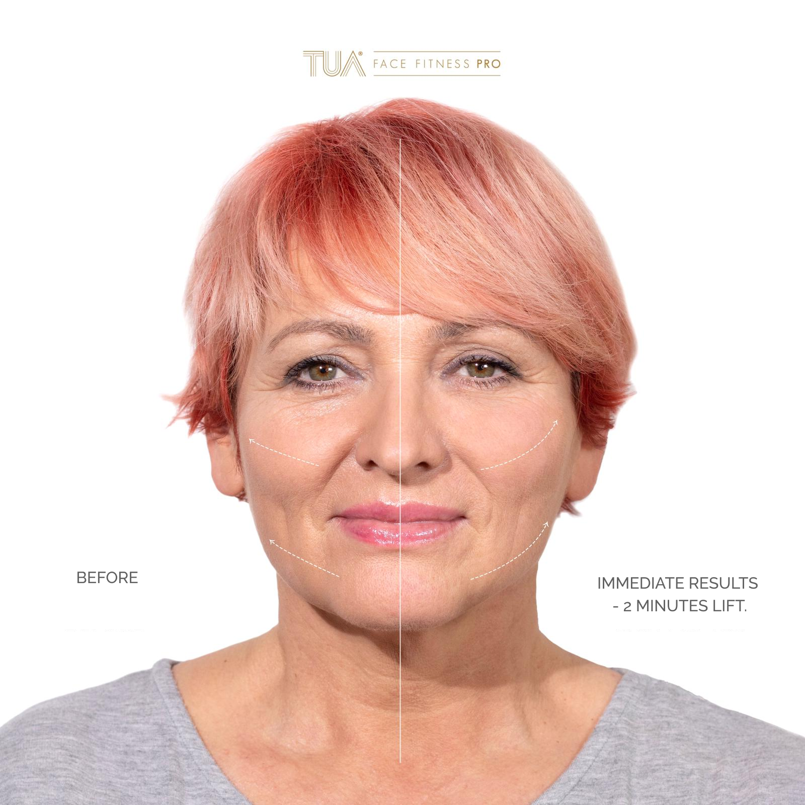 Showcasing of immediate result of using the best face toning device from TUA